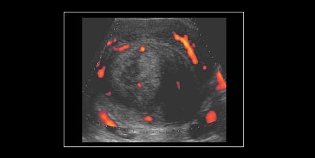 Sonuçları çok tehlikeli olabilir! Kadınlar ‘kilo sanıyor’ ama gerçek bambaşka