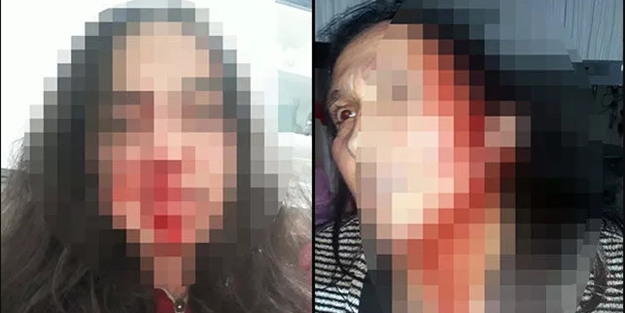 Sosyal medyada paylaştı: Bizi öldürecek