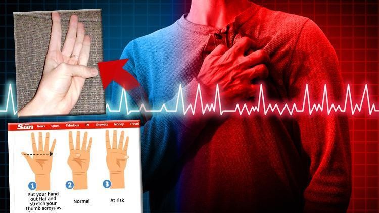 Sosyal medyayı paniğe sürükleyen video: "Basit bir başparmak testi, ölümcül hastalığı ortaya çıkarabilir" Doktorlardan peş peşe açıklama...