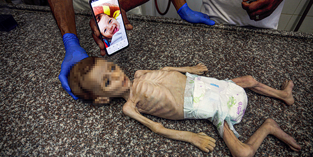 Soyun kurusun İsrail! Açlıktan ölen 7 aylık bebeğin son hali yürekleri dağladı