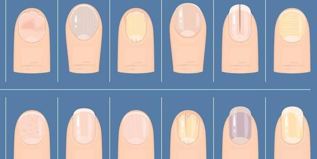 Sözleri dünyayı salladı! Tırnağı böyle olanlar dikkat