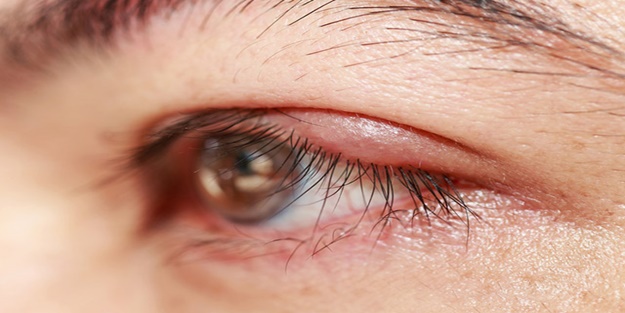 Spor yaparken göz bebeğini parçaladı