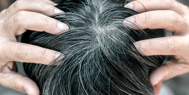 Stres gerçekten saç beyazlatır mı, yoksa bu bir şehir efsanesi mi?