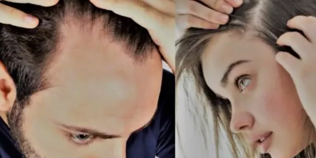 Saç dökülmesinde beslenmenin önemi