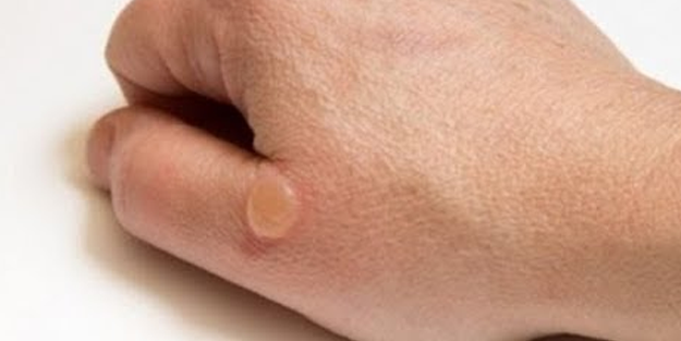 Su toplayan bir yeri neden patlamamamız gerektiğini öğrenince bir daha...