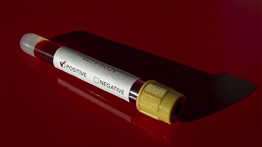 Sudan koronavirüsle mücadele için acil durum yasası çıkardı