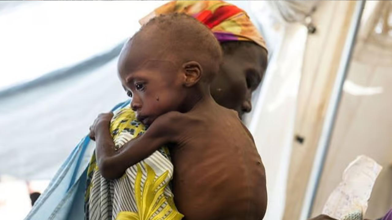 Sudan'da 3 milyon çocuk akut yetersiz beslenme riskiyle karşı karşıya