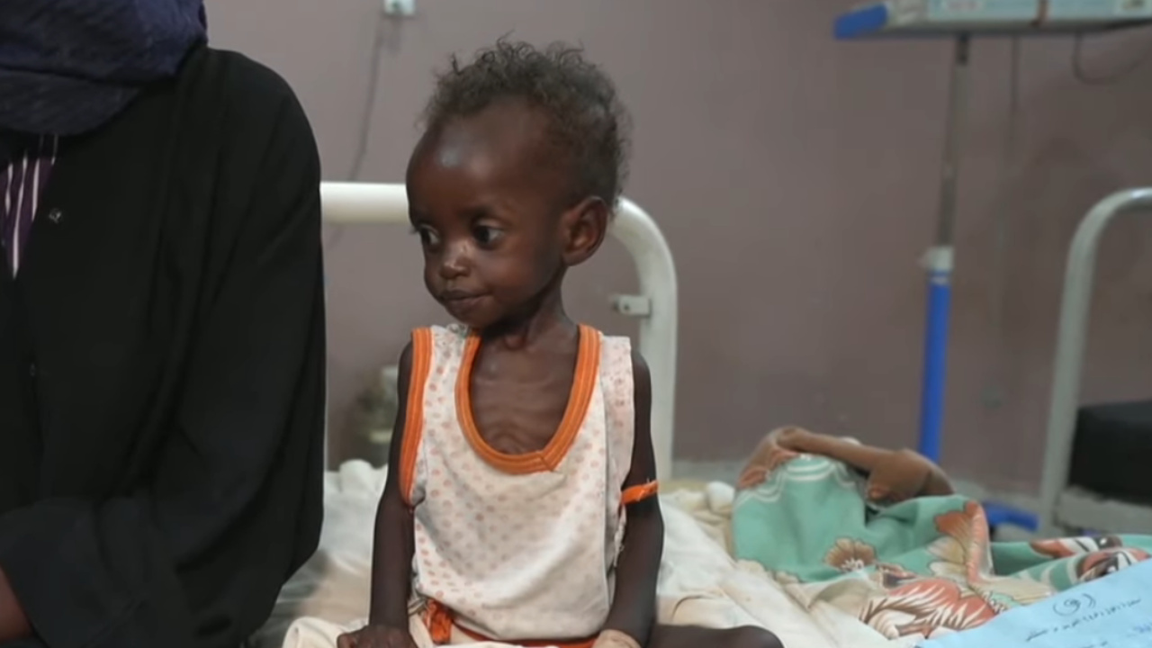 Sudan'da çocuklar açlık kriziyle karşı karşıya!
