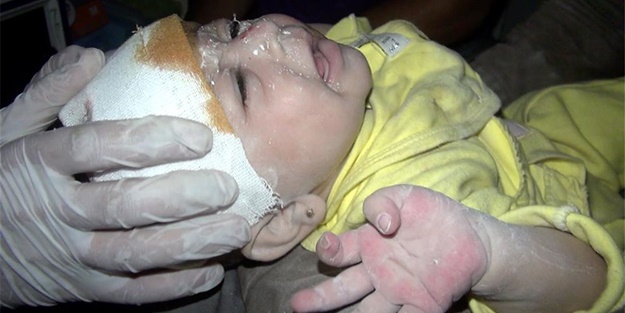 Suriye'de 1 aylık bebek böyle kurtarıldı