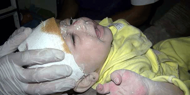 Suriye'de 1 aylık bebek enkazdan sağ çıkarıldı