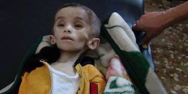 Suriye'de 250 bin çocuk açlık çekiyor