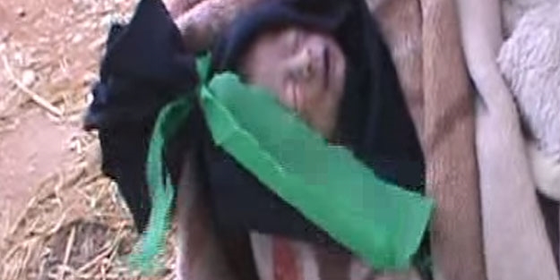 Suriye'de minik Muhammed açlıktan öldü