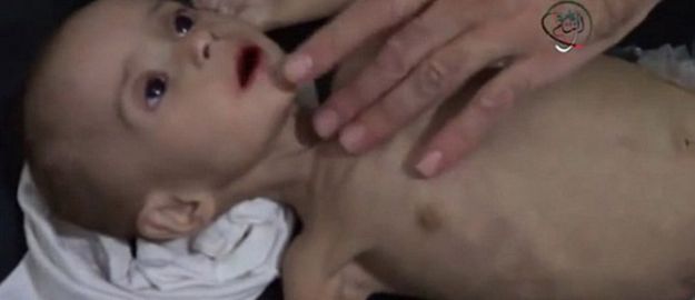 Suriye’de açlıktan ölümler giderek artıyor