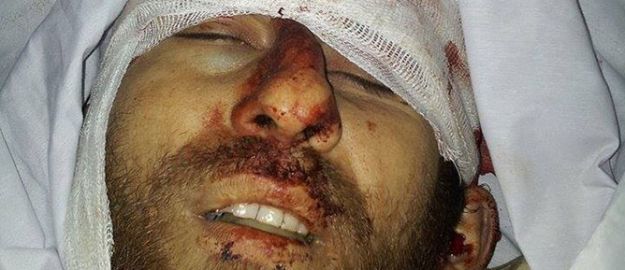 Suriye’de bir Azeri şehit