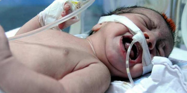 Suriyeli bebeğin boğazından bakın ne çıktı