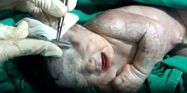 Anne karnında öldü ama...