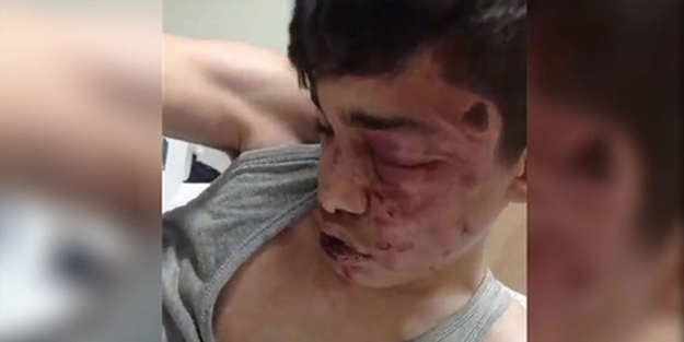 Suriyeli çocuğu darp eden ırkçı karaktersizler tutuklandı!