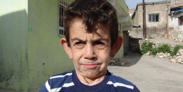 Suriyeli çocuğun yürek yakan dramı