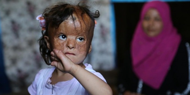 Suriyeli Fatma'nın gözü Türk doktorlarında