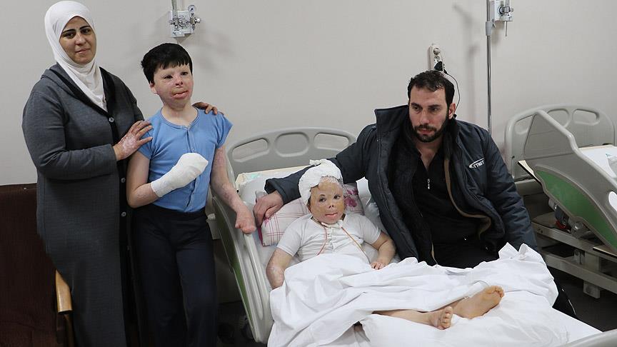 Suriyeli kardeşlerin yüzlerindeki savaş izleri Türkiye'de silinecek