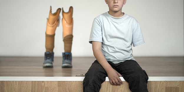 Suriyeli savaş mağdurları için Yüksek Teknolojili Ortez Protez Merkezi