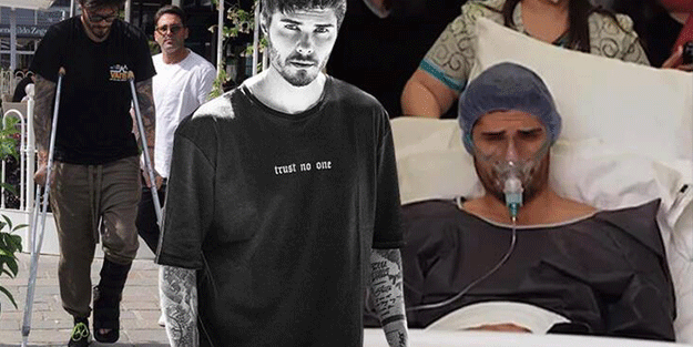 Survivor yarışmasında sakatlandı! Şimdi yürümekte bile zorlanıyor