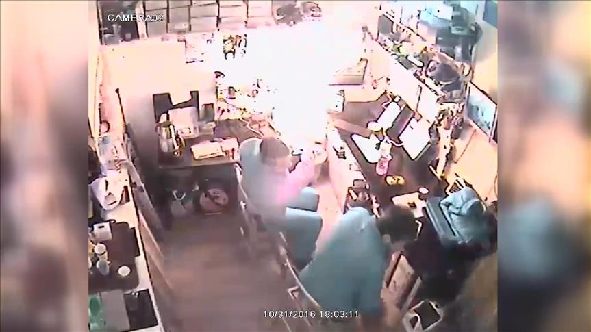 Tablet bilgisayarı tamiri ederken kendini yakıyordu