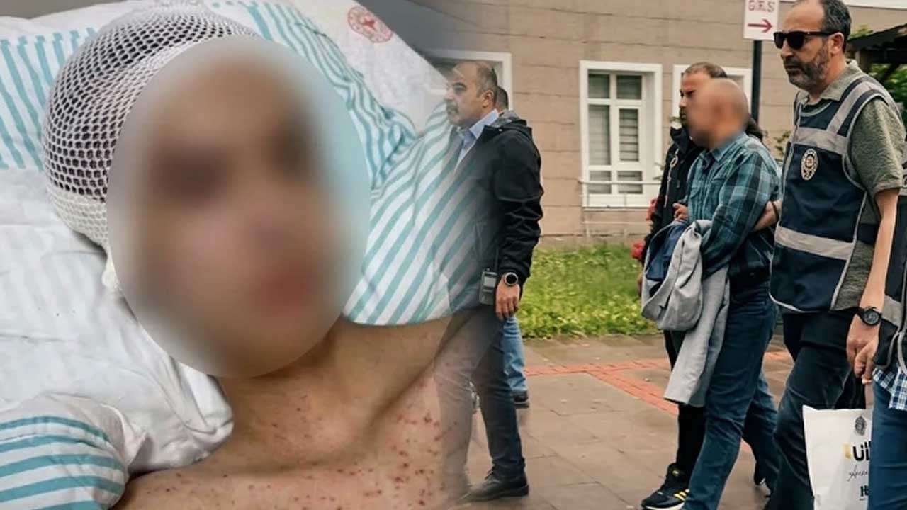 Tacize direnen 14 yaşındaki çocuk felç kaldı! Lanet olsun sizin insanlığınıza