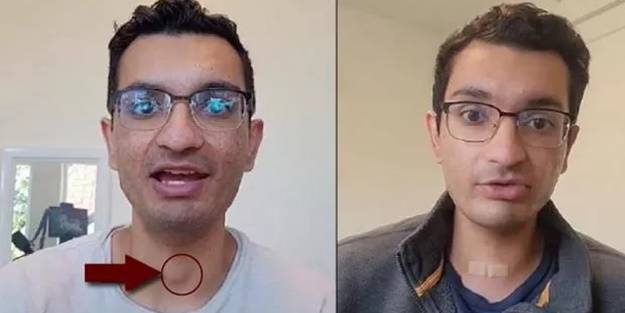 Takipçileri fark etti! Kanser olduğunu sosyal medyadan öğrendi