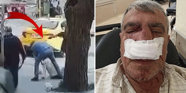 Taksici, yayanın burnunu kırdı!
