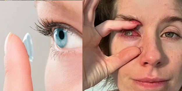 Taktığı lens yüzünden kör oldu!