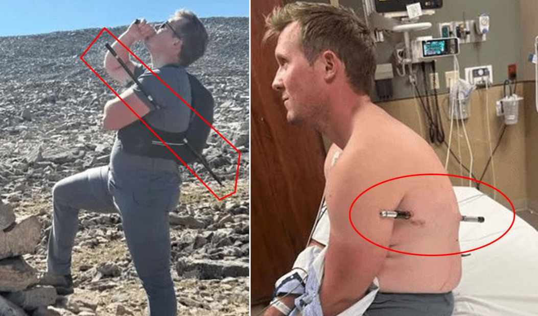  Talihsiz dağcının inanılmaz kurtuluşu: Gövdesini delen sopayla 16 kilometre yürüdü