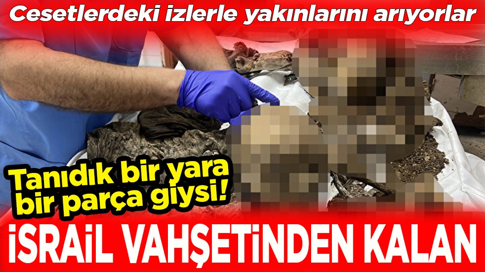 Tanıdık bir yara, bir parça giysi. İsrail vahşetinden kalan