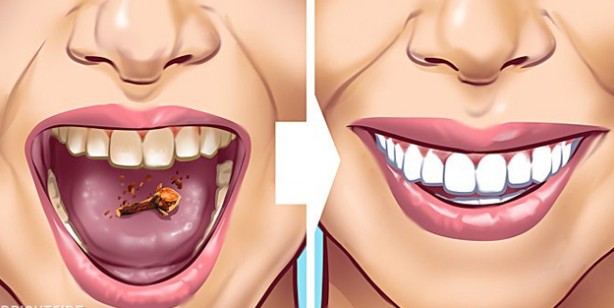 Tartar lekelerini dişlerinizden çıkarmanın 10 yolu: Sarı iken artık gece gündüz Işıl Işıl! Önlem alın