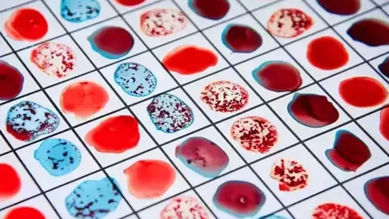 Bu kan grubuna sahip olanların ömrü uzun!