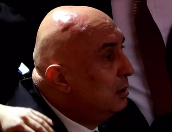 TBMM'de haddi bildirildi: İşte Engin Özkoç'un son hali!