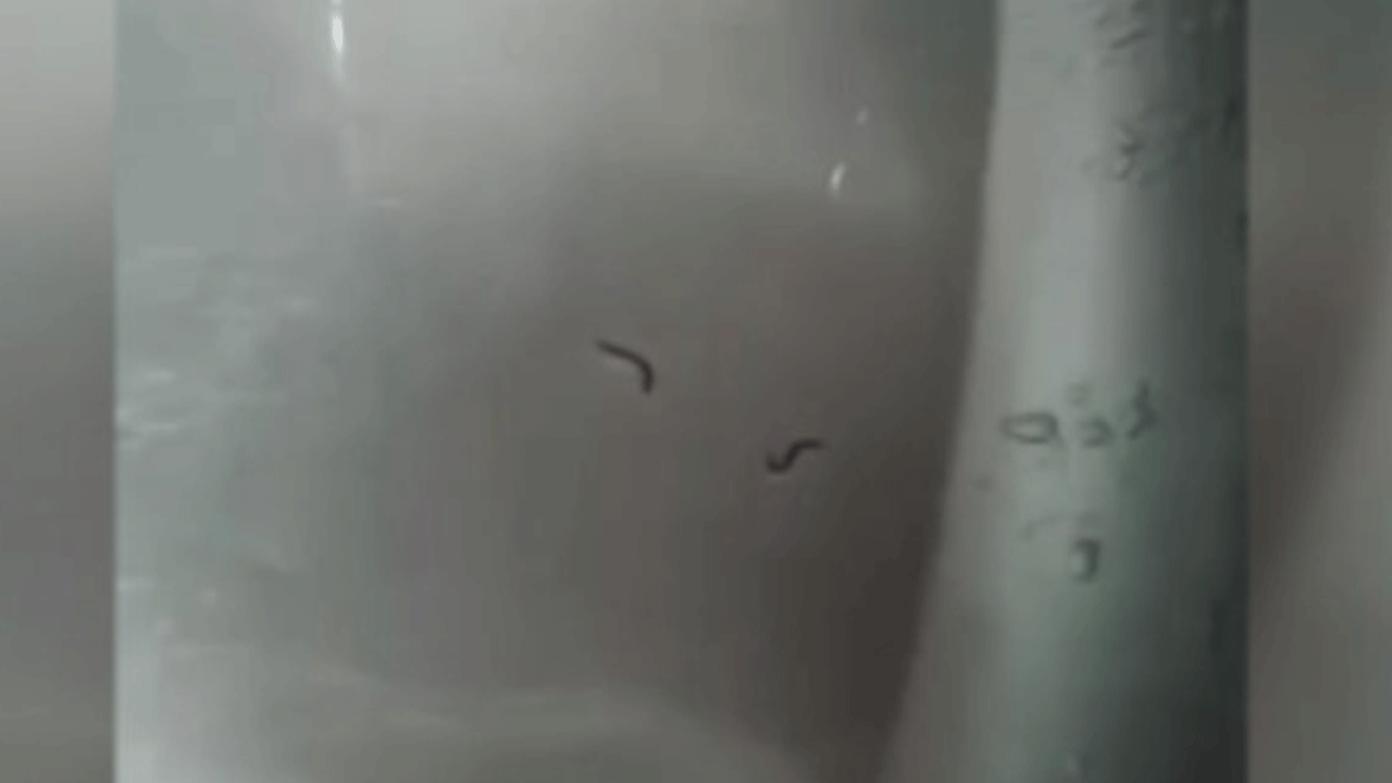 Tekirdağ'da içme suyundan kurt çıktı!