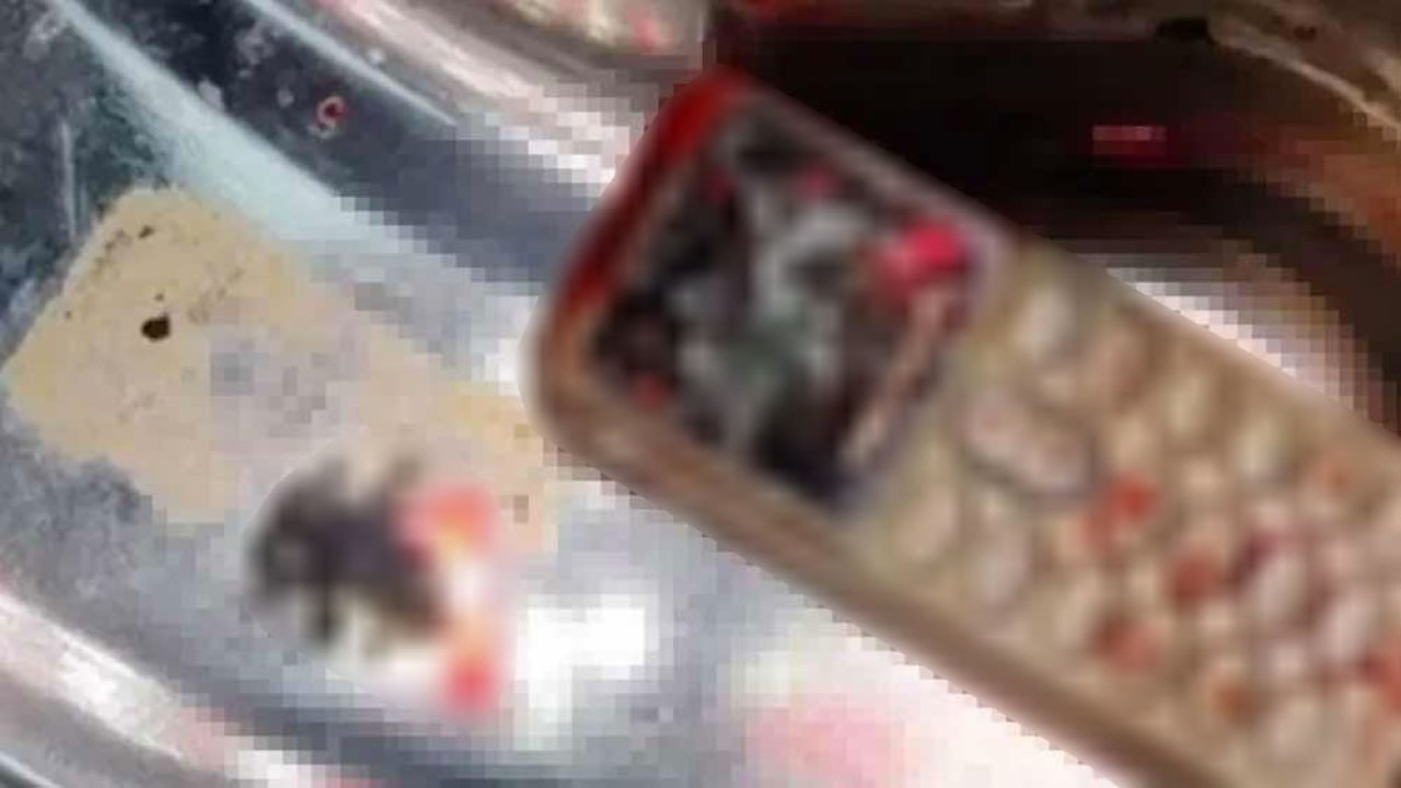 Telefonunu abisine vermemek için yuttu! Telefon genç kızın midesinden ameliyatla alındı