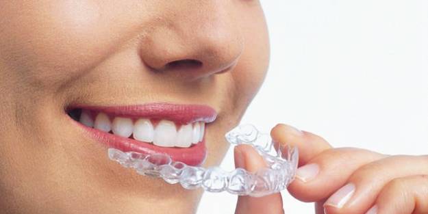 Temizlenmeyen plaklar zarar verebiliyor