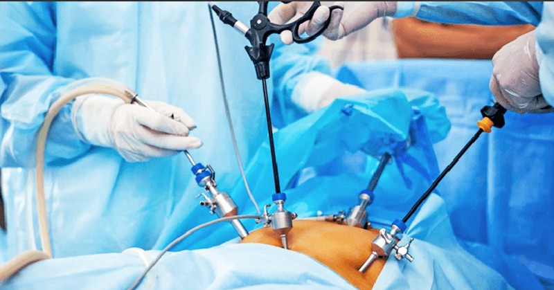 Tercihiniz hangisi olurdu: Tüp mide ameliyatı mı, yoksa mide balonu mu?