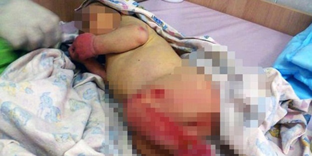 Terk edilen bebeği karıncalar yedi