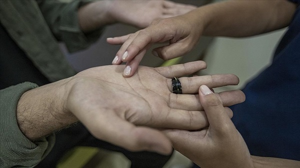 Terleme bakın hangi sorunlara yol açıyor?