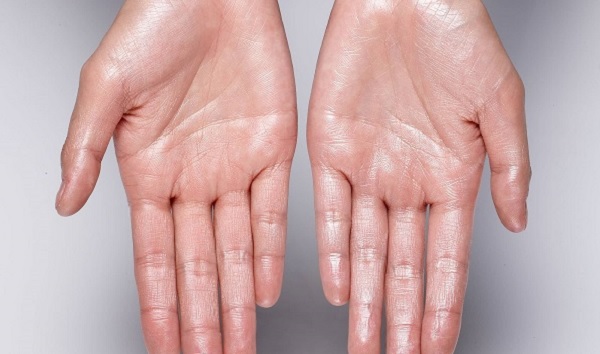 Terleme deyip geçmeyin! Bu belirtiler varsa hemen doktora gitmelisiniz