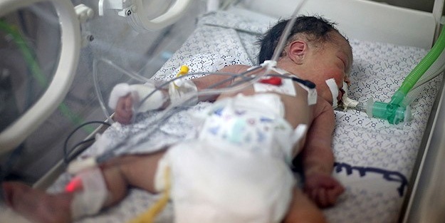 Terör kurbanı Gazzeli minik Şeyma hayata tutunamadı