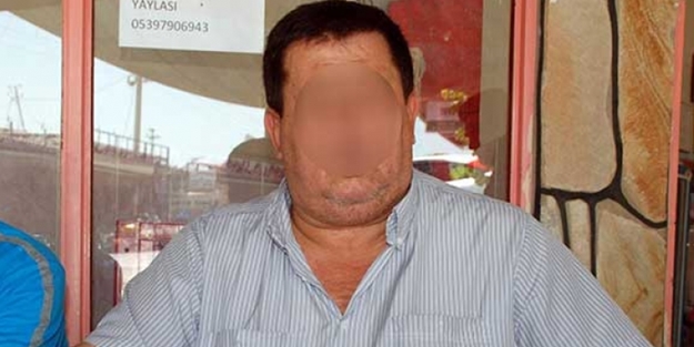 Yol kesen teröristlerden bakın nasıl kurtuldu!