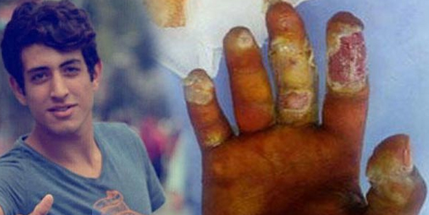 Tesbih sanıp eline almıştı, malulen emekli oldu!