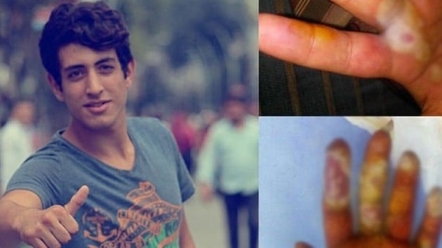 Tespih sandığı radyoaktif madde hayatını kararttı!