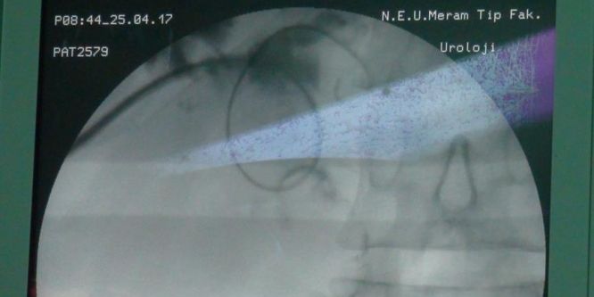 Karaciğer cerrahisinde Türk yazılımı yanılgı payını azaltacak