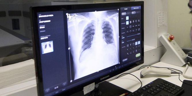 Türkiye'de ilk kez kanser hastasına akciğer nakli yapıldı