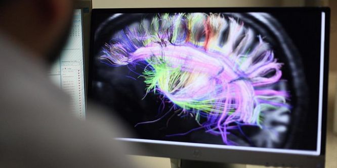 Deliryumun nedeni bulundu